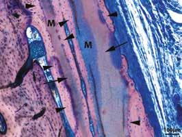 tessuti sottili intorno agli impianti, i difetti estetici, e di correggere deiscenze