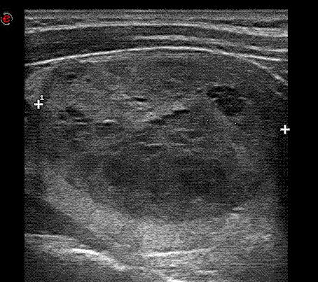 MIDDLE Nodulo small Nodulo Middle