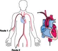 Cenni di anatomia e fisiologia del cuore Il cuore è un muscolo, miocardio, delle dimensioni di un pugno, posizionato al centro della