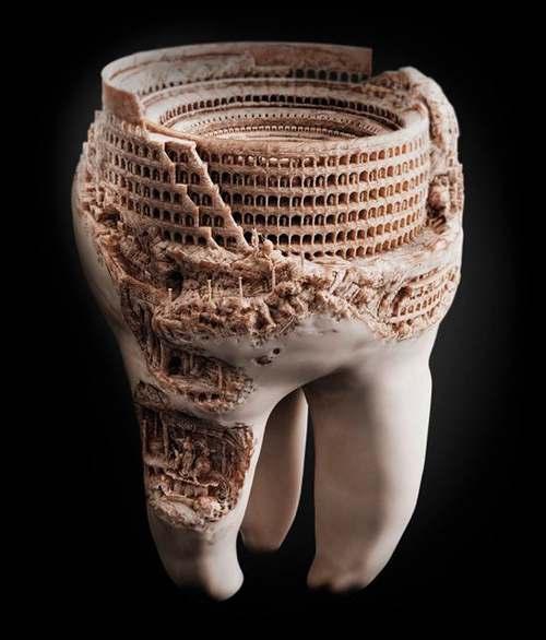 Nel rispetto dell Anatomia del dente TOKU POST «15 Retentione 18 S» sono stati studiati per avere un design e dimensioni che limitino l asportazione di dentina sana ed il conseguente