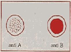 A" il sangue esaminato appartiene al "gruppo A".