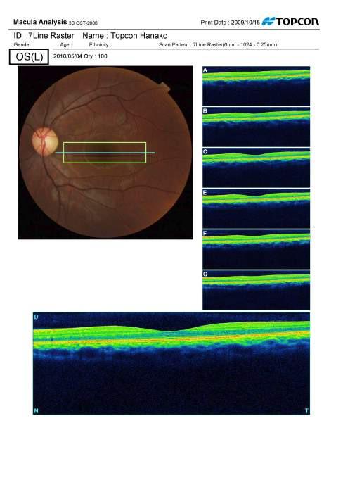 Analisi Macula 7