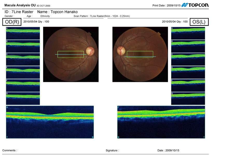 Analisi Macula 7