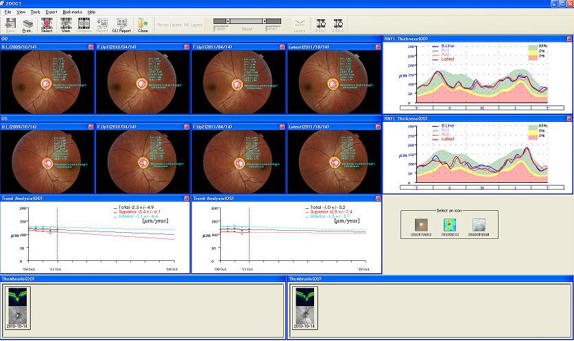 Progression analysis Viewer window Base line data Switch able Stored images (R) Stored images