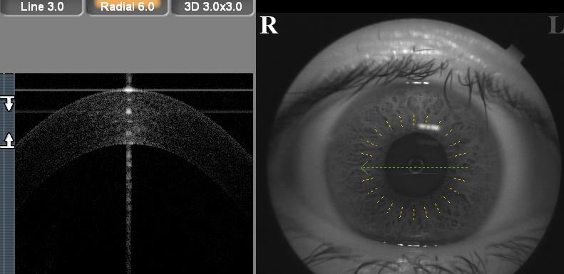 Come acquisire ottime immagini L allineamento è fondamentale per ottenere ottime immagini ed un analisi più accurata Posizionare in centro della