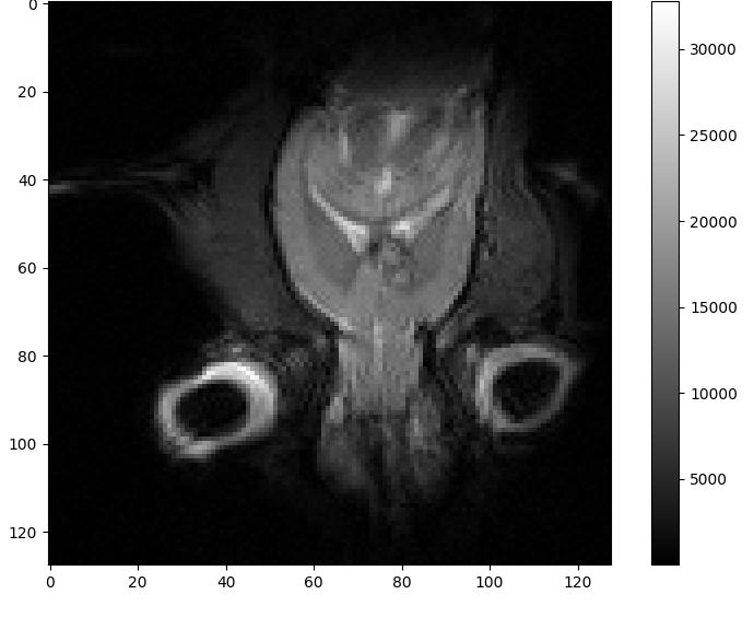 Immagini analizzate: 1H MRI 40 mm In questo studio sono state utilizzate immagini MR di topo acquisite nel 2007 nel progetto di ricerca di S.