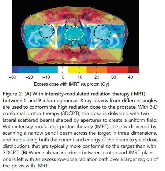 Proton therapy allows for a reduction in the