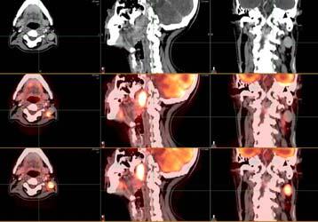 Oncologia Radioterapica: il TSRM