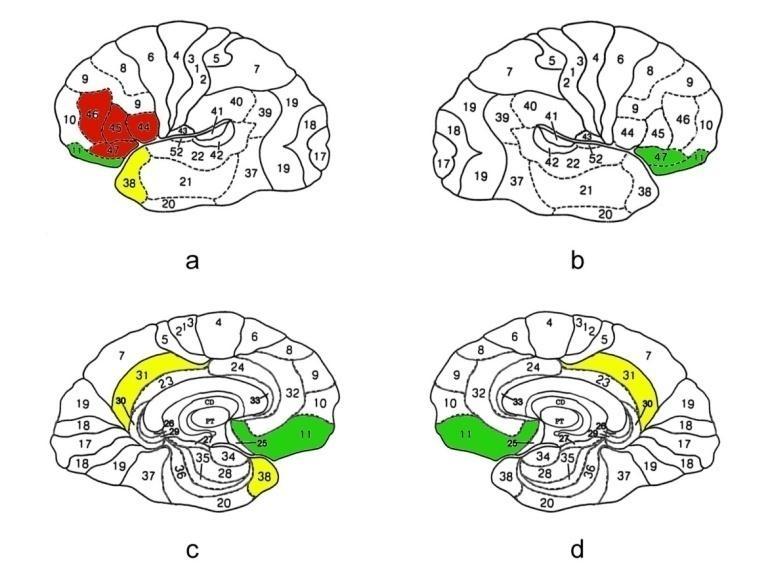 Alzheimer: pre-dementia diagnosis More biomarkers are probably better than one PET scores (Principal Component Analysis) + verbal