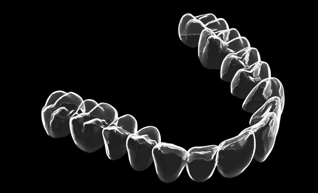 SMILERS COSA SONO? Gli allineatori Smilers sono dei dispositivi ortodontici amovibili, indicati per la correzione di malposizioni dentarie.