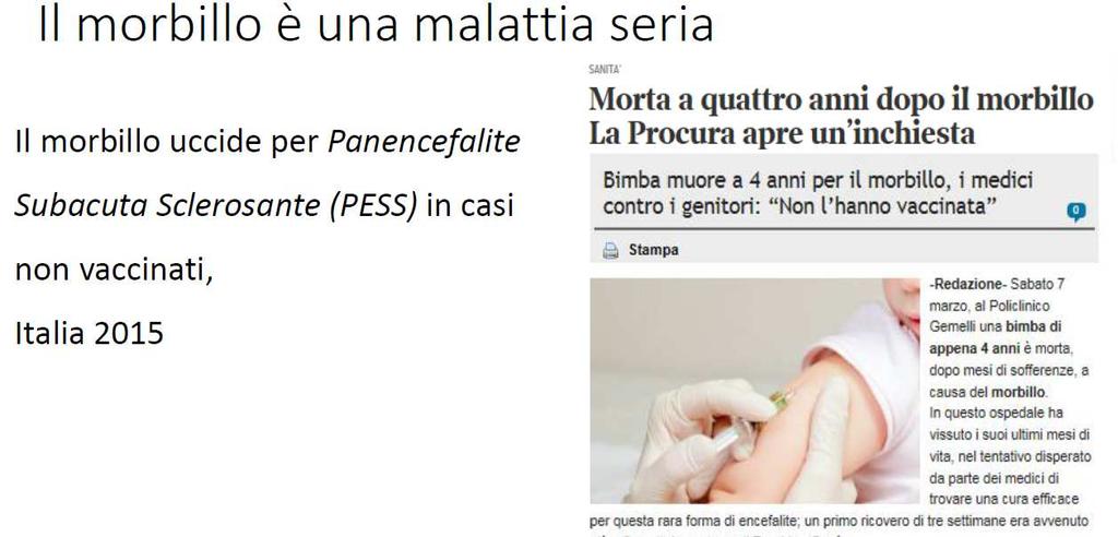 Il morbillo