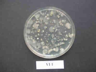 3 mm L. gialla brillante fosforescente mucosa, diametro ca. 2-3 mm M. bianca, diametro < 1 mm, puntiforme N.