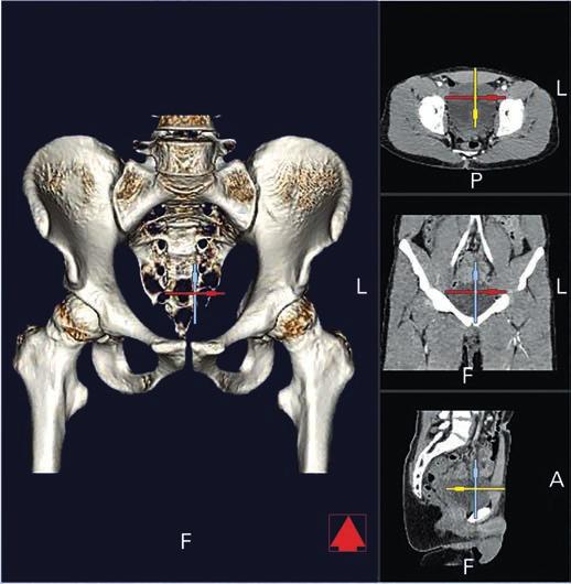 Anatomical 3D and 2D view medicad Hip 3D offre al medico diverse modalità di visualizzazione.