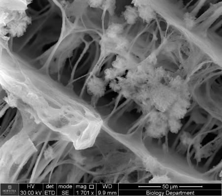 GLYMATRIX Come tutti i prodotti della linea OSSIX, la reticolazione è ottenuta con la tecnologia GLYMATRIX, la tecnologia brevettata di reticolazione del collagene che