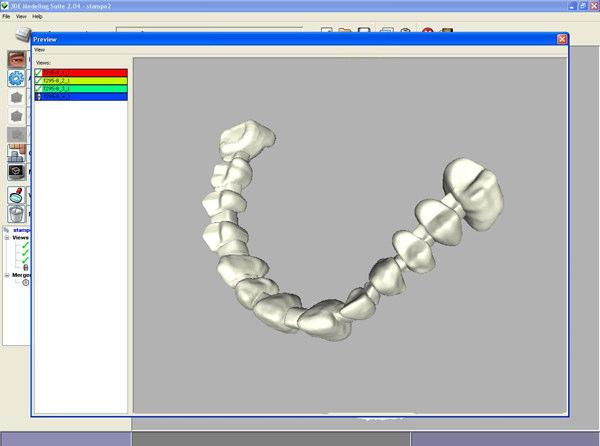 Automatic 3DE Modeling Builder 3DE Modeling Dental Builder si occupa della modellazione 3D automatica di calchi e monconi