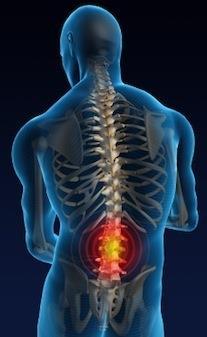 La sindrome lombare 2/3 dei dolori alla colonna colpiscono il tratto lombare.