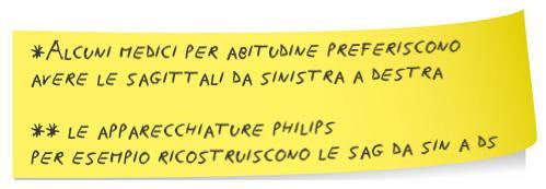 Convenzioni sui piani In coronale gli strati vengono sempre posizionati in senso antero posteriore.