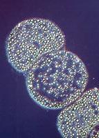 Washington, DC (4/16/99)- Thiomargarita namibiensis, a giant bacterium discovered off the coast of Namibia, has a