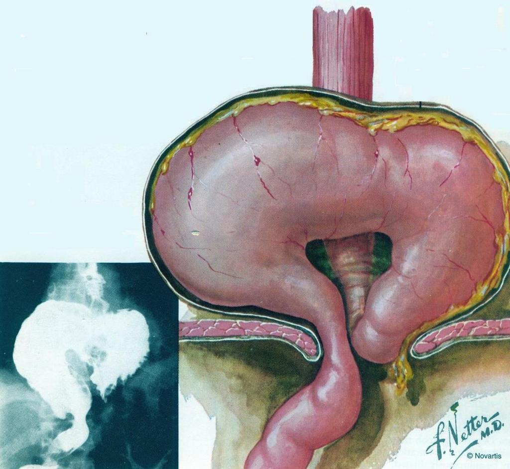 Chirurgia del giunto G-E in Week Surgery