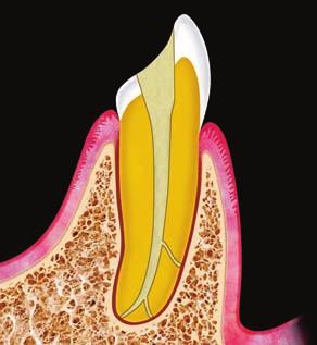 Origine Endodontica.