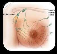 Background 5-10% tumori mammari