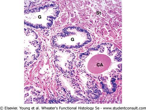 Prostata CA