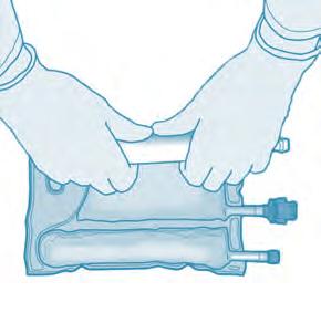 Attivazione della sacca a due compartimenti (rottura della membrana non permanente tra il compartimento degli amminoacidi e il