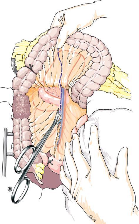 Arteria e vena