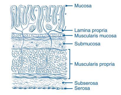 Tumor