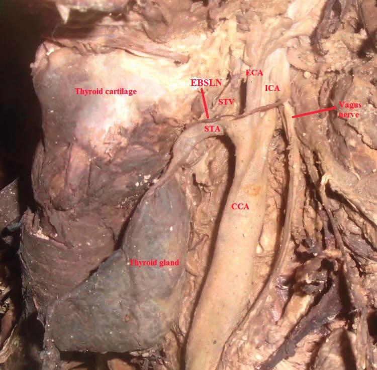 22 OSTEOPATIA VISCERALE Il sistema pneumofonatorio e cardiovascolare Osso ioideo Arteria tiroidea superiore Vena tiroidea superiore Arteria carotide comune Lobo destro della ghiandola tiroidea Vena