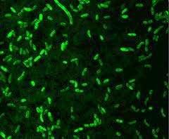 Test di tosscità acuta con batteri bioluminescenti PRINCIPIO DEL METODO I batteri utilizzati per il test di tossicità acuta sono della specie Vibrio fischeri.