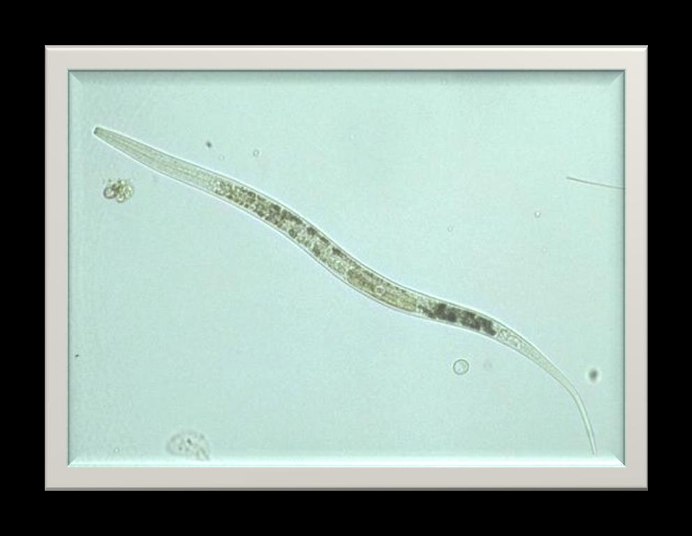 I nematodi o vermi cilindrici sono vermi più complessi rispetto ai platelminti: il loro corpo contiene muscoli e l ano è situato all estremità