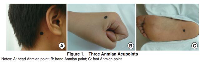 Punti extra Anmian I punti Anmian sono particolarmente efficaci nel trattamento dell insonnia di qualsiasi tipo e nel tuina il punto Anmian della testa può essere utilizzato insieme a tutta la linea