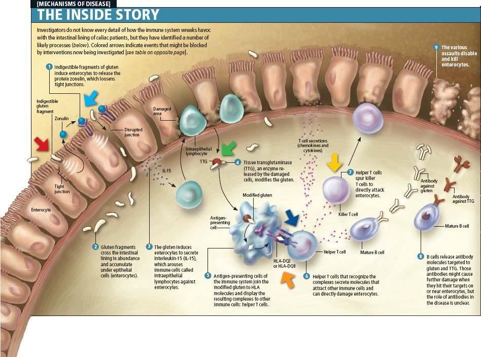 Patogenesi della MC Accumulo intralisosomiale dei peptidi della gliadina (minuti)