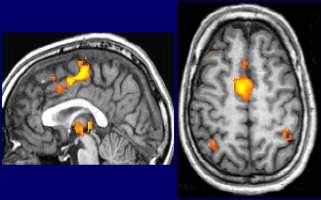 Differenti zone del cervello si attivano