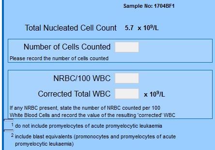 Nel riquadro a sinistra indicare: A) il numero totale di cellule contate (Number of Cells Counted) A B B) la percentuale degli eritroblasti circolanti (NRBC/100 WBC) C) il numero assoluto corretto