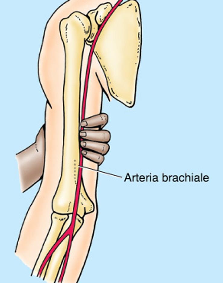 IRRORAZIONE arteriosa