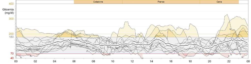 CGM ed