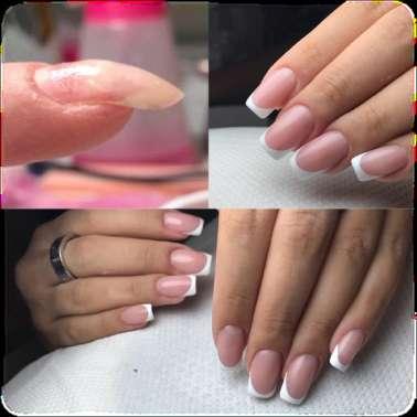 IMPROVED NAILS Trovarsi difronte ad una cliente con un onicogrifosi, unghie a cucchiaio e/o problematiche e non saper correggere questi difetti non farà di