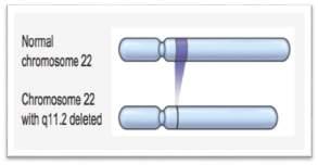 q11.2. Attualmente ha in cura più di 400 pazienti, la maggioranza dei quali portatori di microdelezione 22q.