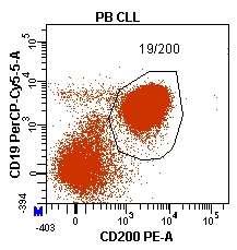 CLL e MCL: differenze