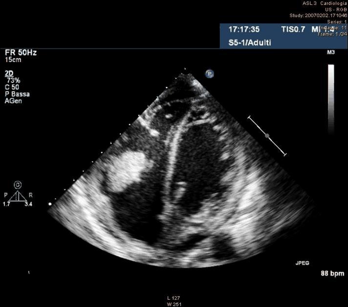 2. I CRITERI DIAGNOSTICI DI DUKE HANNO