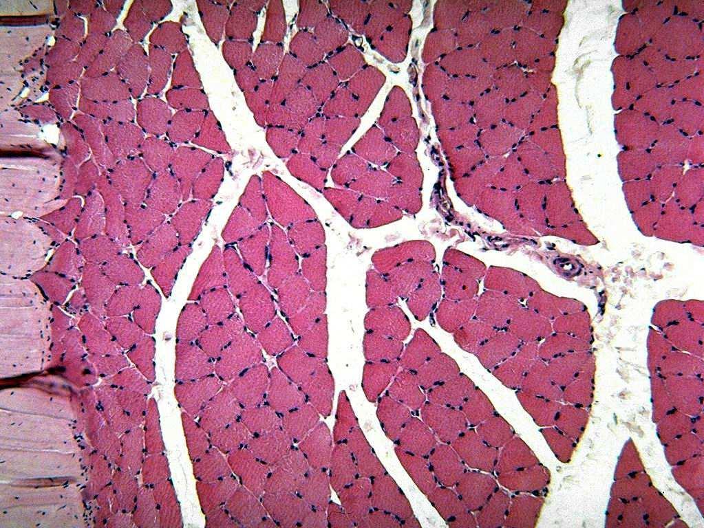 muscolo scheletrico in sezione trasversale