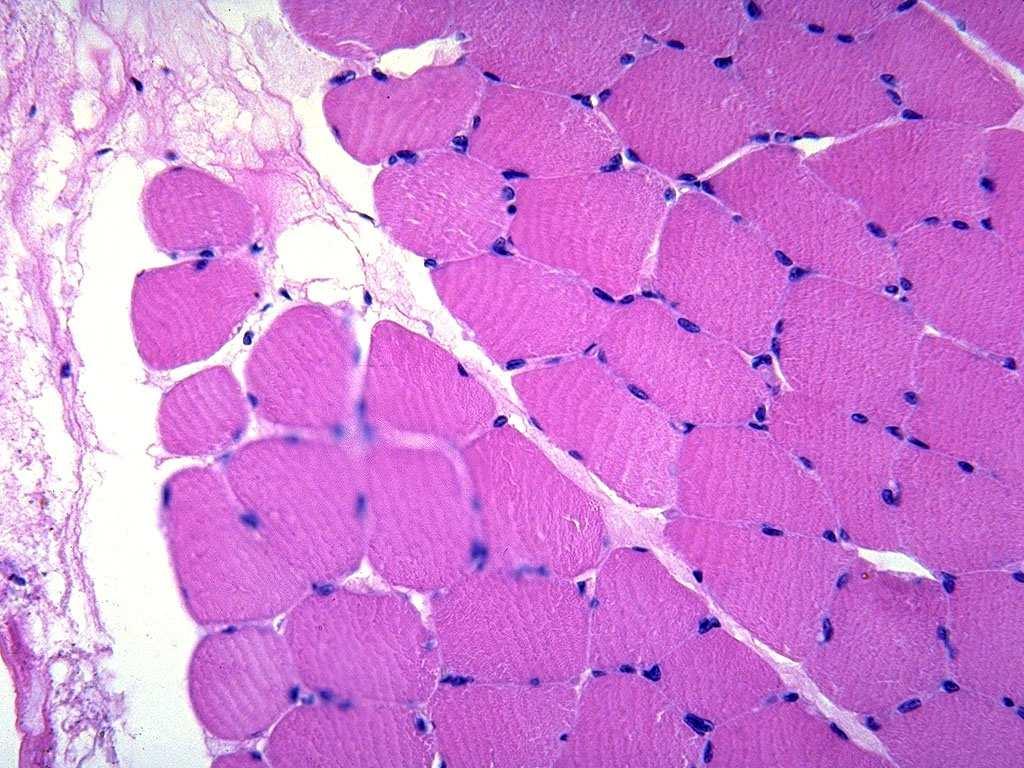 muscolo scheletrico in sezione trasversale cellula muscolare scheletrica ogni cellula presenta