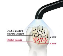 APPROFONDIMENTI Nuovo fotoattivatore in Tetric EvoCeram Bulk Fill Incrementi di 4 mm, un estetica naturale e brevi tempi di esposizione alla luce sono una contraddizione? No.