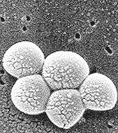 Figura 3 - Staphylococcus aureus meticillino-resistente (microscopia elettronica a scansione SEM).