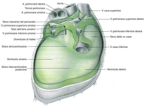 Ablazione per via epicardica Questa procedura permette di esplorare il versante esterno dei due ventricoli del cuore attraverso l inserimento di cateteri introdotti nello spazio virtuale posto fra i