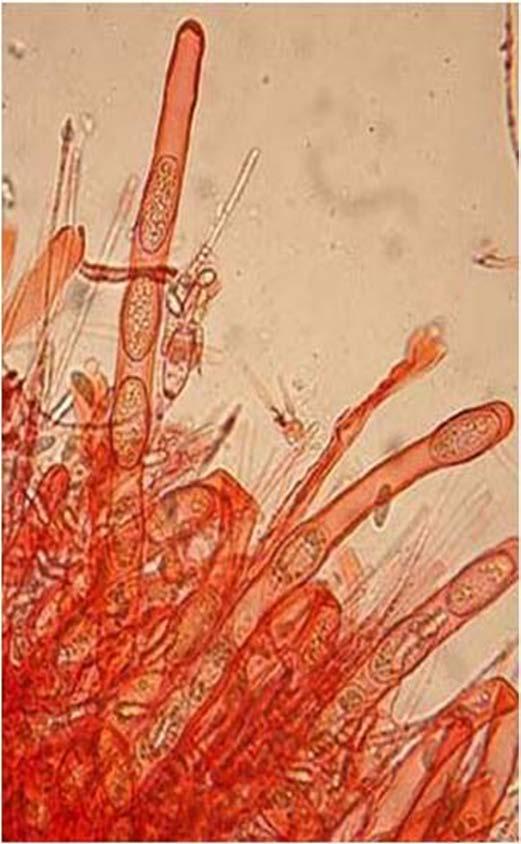 CICLO VITALE Le spore in condizioni favorevoli, germinano originando delle cellule aploidi mobili tipo amebe. La fusione di due cellule ameboidi genera lo zigote.
