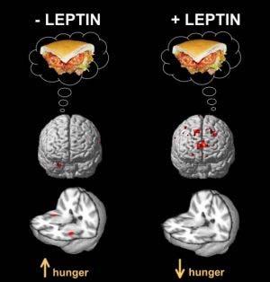 Ricercatori dell UCLA hanno identificato i circuiti cerebrali che controllano la fame Negli adulti che hanno un raro gene che comporta un deficit di leptin, la rievocazione mnesica del cibo produce