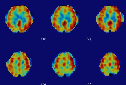 Rispetto alla baseline, si verifica un forte aumento del flusso